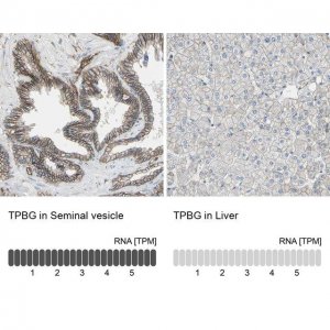 Anti-TPBG antibody produced in rabbit HPA010554-100UL
