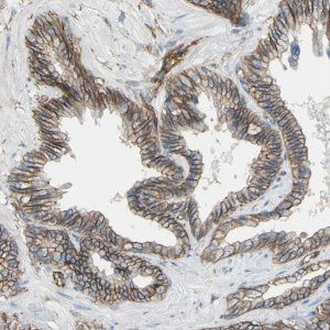 Anti-TPBG antibody produced in rabbit HPA010554-100UL