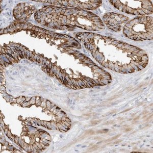 Anti-TPCN2 antibody produced in rabbit 
