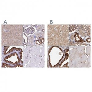 Anti-TPD52 antibody produced in rabbit HPA062167-100UL