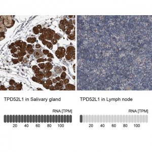 Anti-TPD52L1 antibody produced in rabbit 