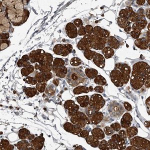 Anti-TPD52L1 antibody produced in rabbit 