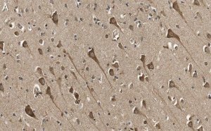Anti-TPH-1 Antibody, clone 3J7 ZooMAb Rabbit Monoclonal 