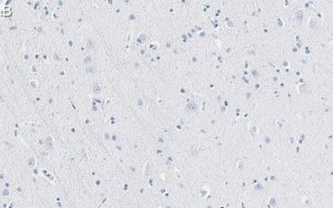 Anti-TPH-1 Antibody, clone 3J7 ZooMAb Rabbit Monoclonal 