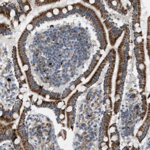 Anti-TPH1 antibody produced in rabbit 
