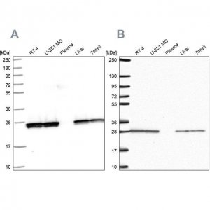 Anti-TPI1 antibody produced in rabbit 
