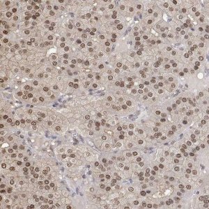 Anti-TPI1 antibody produced in rabbit 