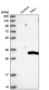 Anti-TPK1 antibody produced in rabbit HPA021545-100UL