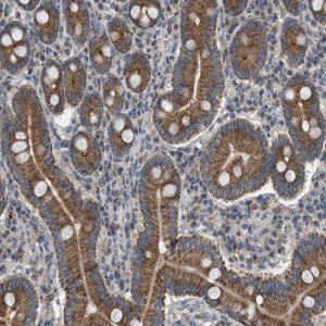 Anti-TPK1 antibody produced in rabbit HPA021545-100UL