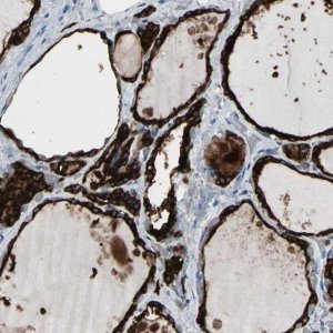 Anti-TPO antibody produced in rabbit 
