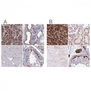 Anti-TPP1 antibody produced in rabbit 