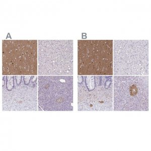Anti-TPPP antibody produced in rabbit 