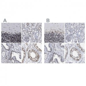 Anti-TPR antibody produced in rabbit 