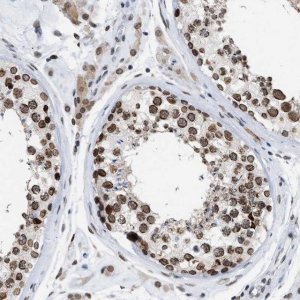 Anti-TPR antibody produced in rabbit 