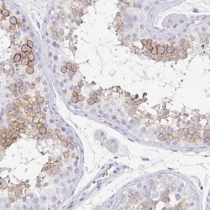 Anti-TPTE antibody produced in rabbit 
