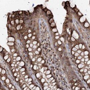 Anti-TRAF3IP2 antibody produced in rabbit 