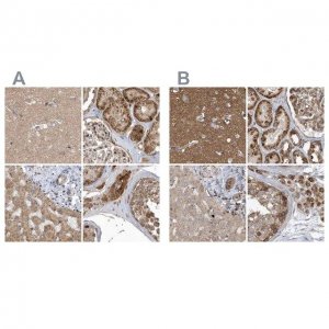 Anti-TRAIP antibody produced in rabbit 