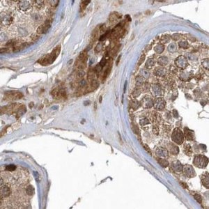 Anti-TRAIP antibody produced in rabbit 