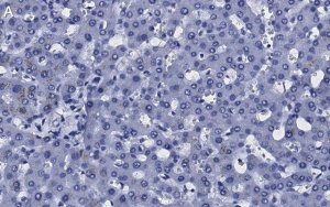 Anti-Transferrin Antibody, clone 2B8 , ZooMAb Rabbit Monoclonal 