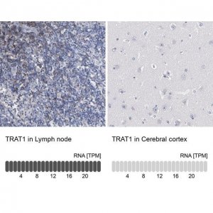 Anti-TRAT1 antibody produced in rabbit 