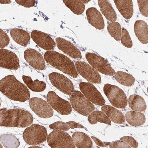 Anti-TRDN antibody produced in rabbit 