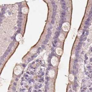 Anti-TREH antibody produced in rabbit 