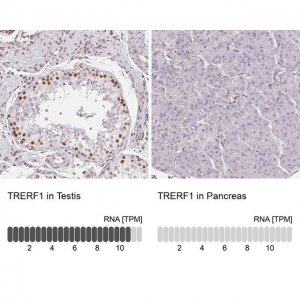 Anti-TRERF1 antibody produced in rabbit 