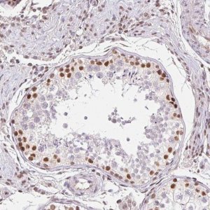 Anti-TRERF1 antibody produced in rabbit 