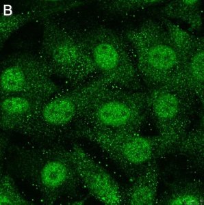 Anti-Treslin Antibody, clone 5L19 ZooMAb Rabbit Monoclonal 