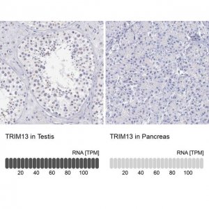 Anti-TRIM13 antibody produced in rabbit 