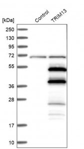 Anti-TRIM13 antibody produced in rabbit 