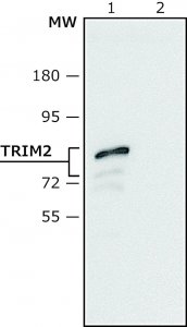 Anti-TRIM2 (C-terminal region) antibody produced in rabbit 