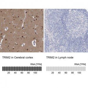Anti-TRIM2 antibody produced in rabbit 