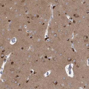Anti-TRIM2 antibody produced in rabbit 