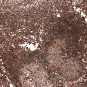 Anti-TRIM21 antibody produced in rabbit 