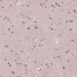 Anti-TRIM69 antibody produced in rabbit HPA028894-100UL