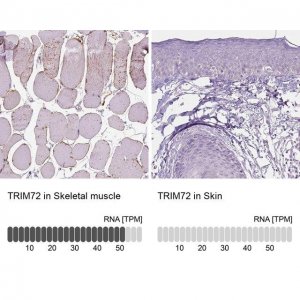 Anti-TRIM72 antibody produced in rabbit 