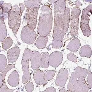Anti-TRIM72 antibody produced in rabbit 