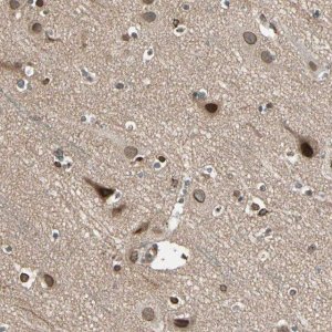 Anti-TRIO antibody produced in rabbit 