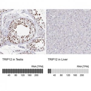 Anti-TRIP12 antibody produced in rabbit 