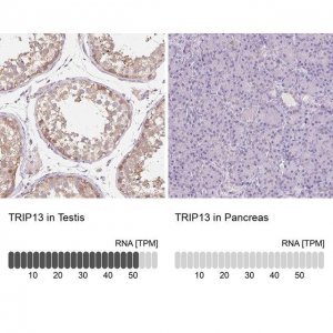 Anti-TRIP13 antibody produced in rabbit 