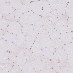 Anti-TRIP13 antibody produced in rabbit 