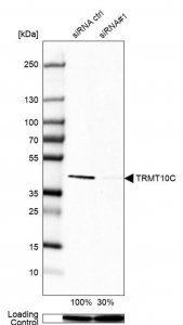 Anti-TRMT10C antibody produced in rabbit 