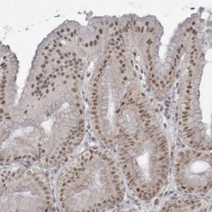 Anti-TRMT10C antibody produced in rabbit 