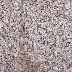 Anti-TRMT112 antibody produced in rabbit 