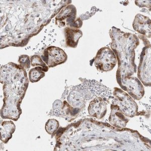 Anti-TRMT1L antibody produced in rabbit 