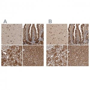 Anti-TRMT61B antibody produced in rabbit 