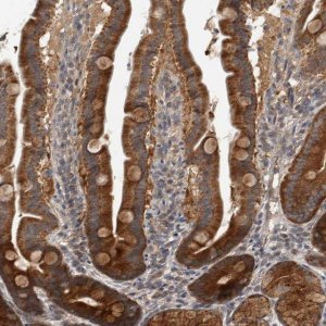 Anti-TRMT61B antibody produced in rabbit 
