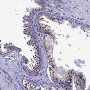 Anti-TRPM5 antibody produced in rabbit 