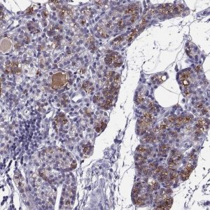Anti-TRPM7 antibody produced in rabbit 